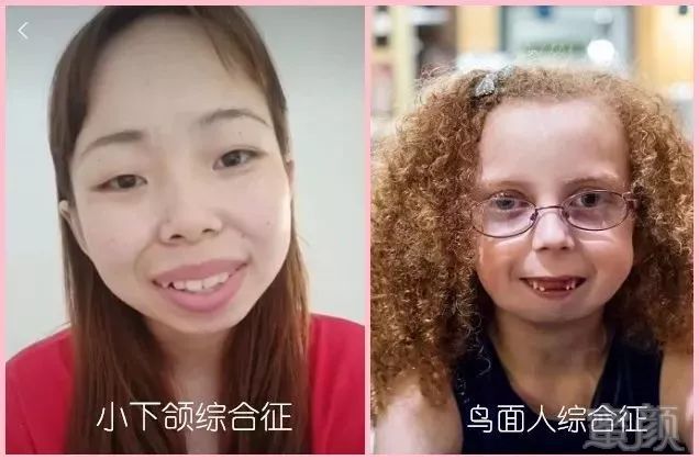 揭秘审美观比较畸形的人面相特点如何？(图)