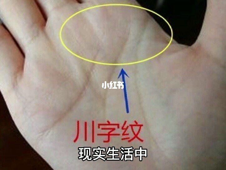 （李向东）手掌川字纹好不好？