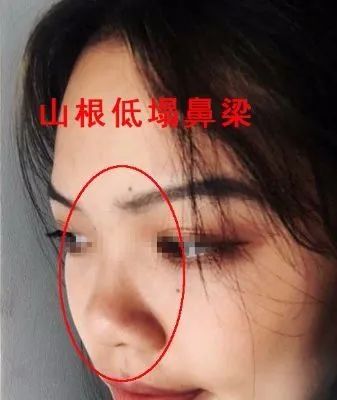 鼻子看性器，汉子塌鼻梁，女人塌鼻子面相