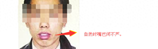 男人不能选的9种面相，你有吗？