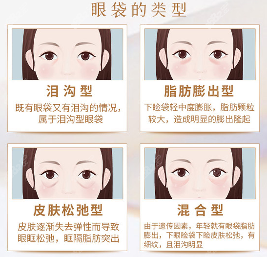 （李向东）眼皮有痣的人有心机在哪？