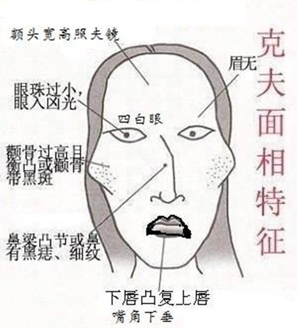 （李向东）真正心黑的人面相是怎样的？