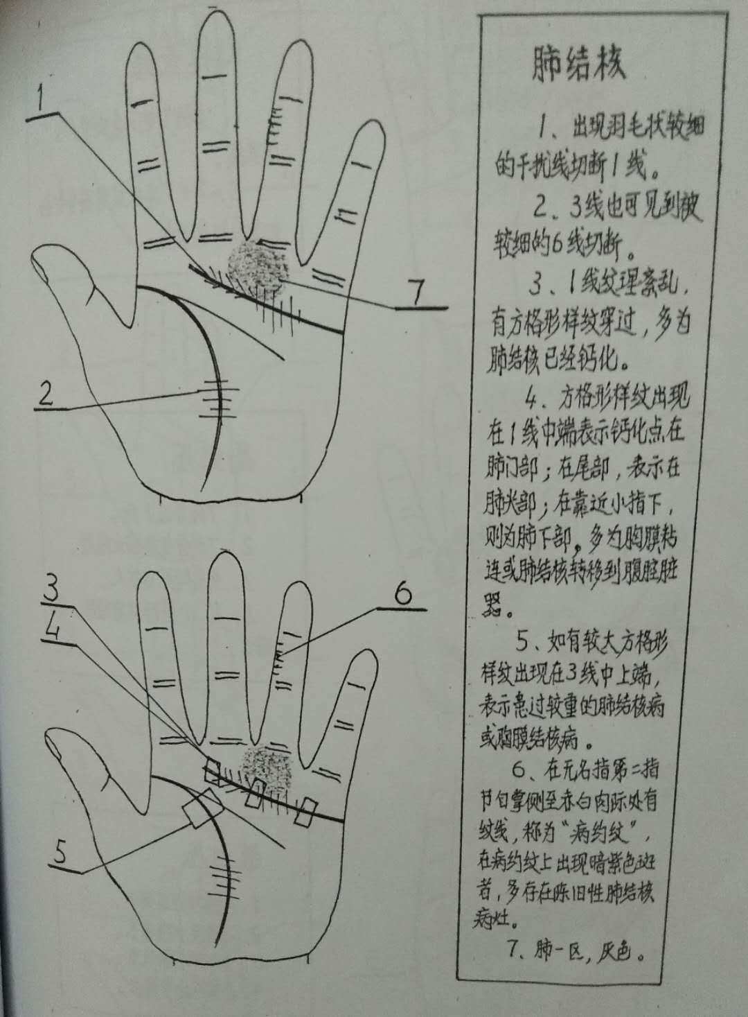 手相健康线多条代表什么手相（图解）