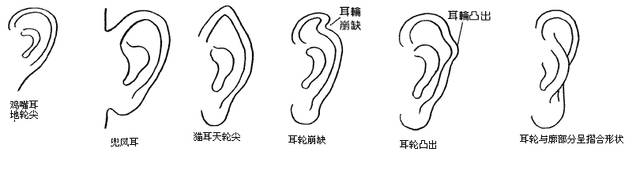 （李向东）从耳朵看面相大全大耳稳重谨慎头脑清醒