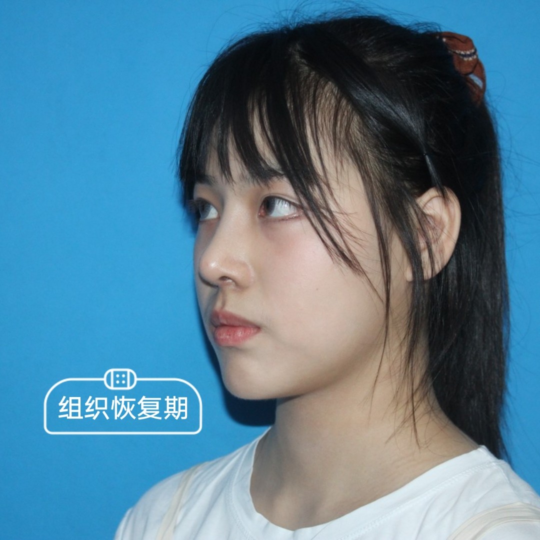 （李向东）女生山根低鼻子大面相说明了什么？