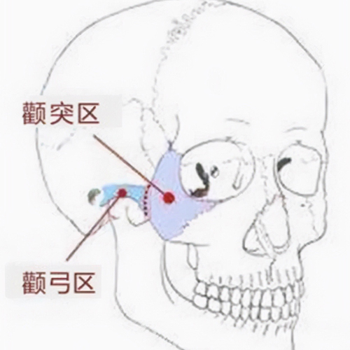 （李向东）“九龙骨”指的到底是什么？